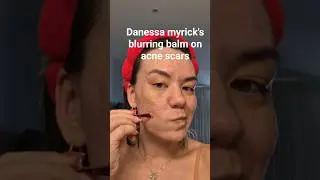 Applying Danessa Myricks Blurring Balm & blushes on Acne scarred skin.