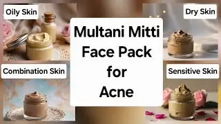  Multani mitti face pack/ how to reduce acne/Acne treatment at home/ Pimple marks removal at home