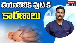 Diabetic Foot : What is Diabetic Foot ? | Dr.Narendranadh Meda | @MedPlusONETV