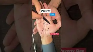 Poverty prediction in hand |life line| #palmistry #subscribe #wealth #rich #love #shorts #videos #AR