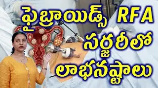 ఫైబ్రాయిడ్స్ RFAసర్జరీ లాభనష్టాలుBenifits Risks of Fibroids Removal Surgery Radio Frequency Ablation