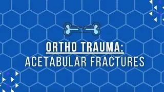 Ortho Trauma Series: Acetabular Fractures with Jacob Frisbie