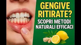 GENGIVE RITIRATE? SCOPRI METODI NATURALI EFFICACI!