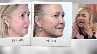VENOIA testimonials Barbara Barnelle