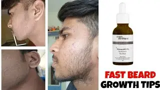 Minoxidil fast beard growth tips | don't this mistake for beard growth | minoxidil beard growth |