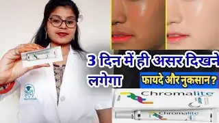 Chromalite night Cream honest review,Chromalite night cream benefits uses&Sideeffects review inhindi