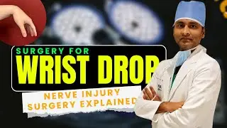 Surgery for Wrist Drop: Restoring Hand Function After Nerve Injury - Dr. Arun Pandey