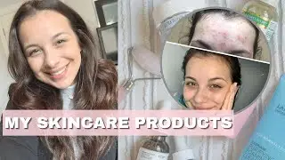 SKIN CARE PRODUCTS 2020 | the products that helped my acne