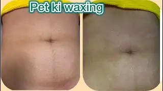 PET KI WAXING, How to do stomach waxing at home🤰 || Belly waxing fast and easy||