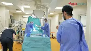 Interventie de revascularizare a piciorului diabetic