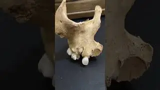 7 Y/o MAXILLA #humanbones #humanskull #skeleton #humananatomy