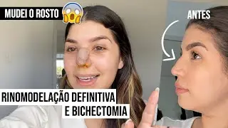 FIZ RINOMODELAÇÃO DEFINITIVA E BICHECTOMIA - como foi todo o processo | por Jessica Melo