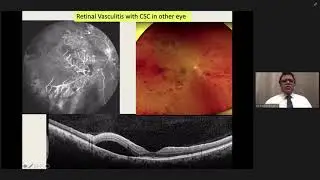 Retina For All   Dr  ATUL KUMAR