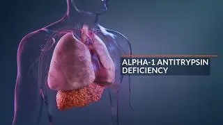 Alpha-1 Antitrypsin Deficiency (AATD) Animation