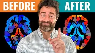 Do THIS Every Morning for Better Brain Health