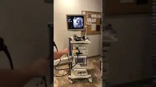 Olympus Gastroscope Demonstration 01/2020
