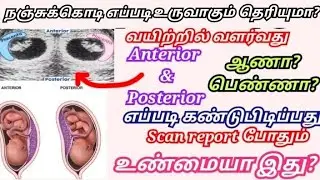 How to identify baby gender from scanreport in tamil/Anterior and posterior placenta#boybaby#girbaby