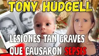 Su cuerpo se inflam&oacute; y endureci&oacute;: La impactante historia de Tony Hudgell