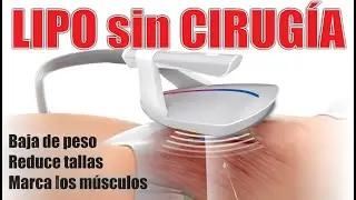 LIPO SIN CIRUGÍA con USM SCULPTOR 💖 REDUCE PESO y TALLAS  📌ETERNA JUVENTUD MEDICAL ESTETIC CENTER