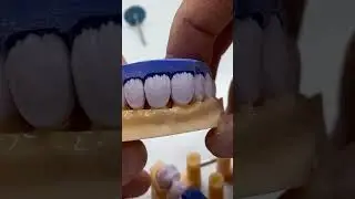 Cutback Diş Yapımı | T&uuml;m detaylarıyla