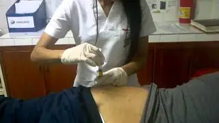 inyección intramuscular