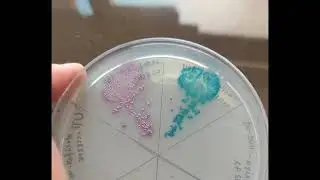 Identification of bacterial colonies