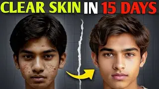 39X Glow on Your Skin ! Tips for Naturally Glowing Skin & Home Remedy | Skin Care Routine | 2025
