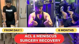 ACL Recovery from Day 1 to 6 months I My ACL and Meniscus Surgery Recovery Journey