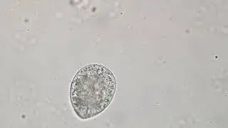 Ichthyophthirius multifiliis cyst (suspected)