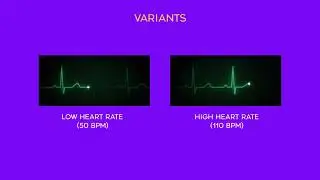 Modulating Heart Activity and Task Performance using Haptic Heartbeat Feedback: A Study Across Fo...