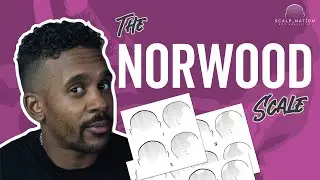 The Norwood scale explained for hair loss