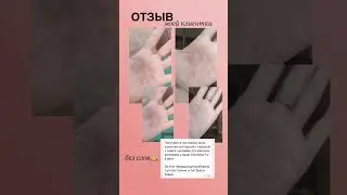 Экзема , дерматит, как помочь