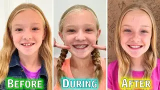Trinity Gets Her Braces Off!!!