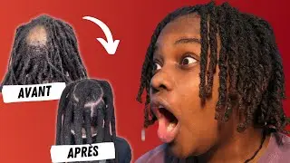 Il A Caché Sa Calvitie Avec Une Locks ⁉️⁉️‼️ (Wicks Locks)