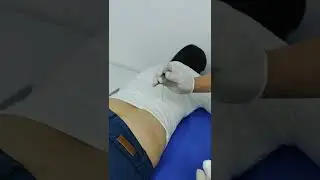 procedimiento inyectologia