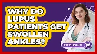 Why Do Lupus Patients Get Swollen Ankles?