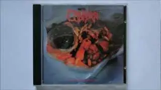 Cadaver - Abnormal Deformity