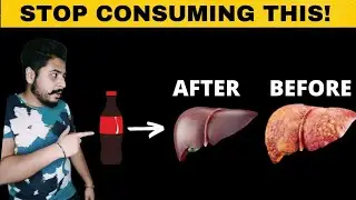 Cold drink harmful effects in hindi || yeh galti mat karo 😱