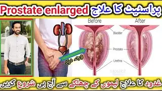 Prostate Enlargement Treatment|Drink one cup Per Day For prostate