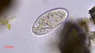 Pleuronema sp.