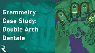 Grammetry Case Study: Double Arch Dentate