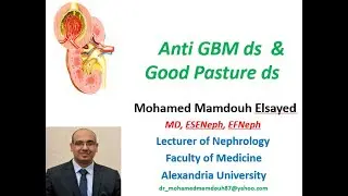 Anti GBM & Good pasture ds (KDIG0 2020)