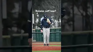 What is the worst baseball injury?? #baseballszn #music #sports #mlb #foryou #baseball #injury