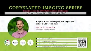 Cryo-CLEM strategies for cryo-FIB milled adherent cells