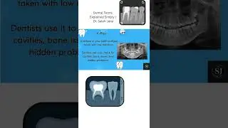 Dental terms  X ray