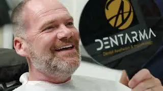 ✨ George&rsquo;s First Trial with His Fixed Temporary Teeth ✨ #allon4turkey #allon6turkey