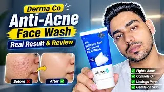 I Tried The Derma Co Anti-Acne Face Wash for 3 Weeks | Real Results & Review |