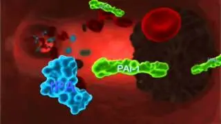 DPharm THR18 - What happened in the blood vessels during a stroke?