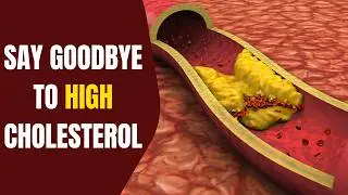 Natural Ways to Lower Cholesterol | Fight Against Silent Killer | Boost Heart Health