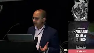 Ileocaecal Tuberculosis - Radiology Review Course
